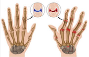 Copper fiber sports health half blood recovery gloves